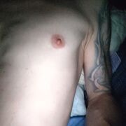 pronychel